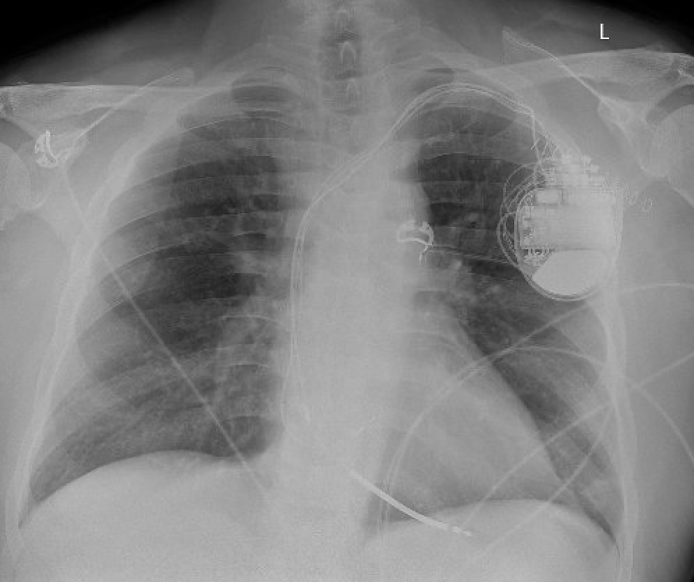 Sergio Pinski tweet media