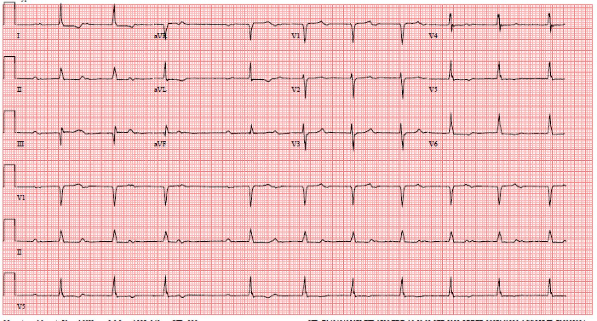 Sergio Pinski tweet media