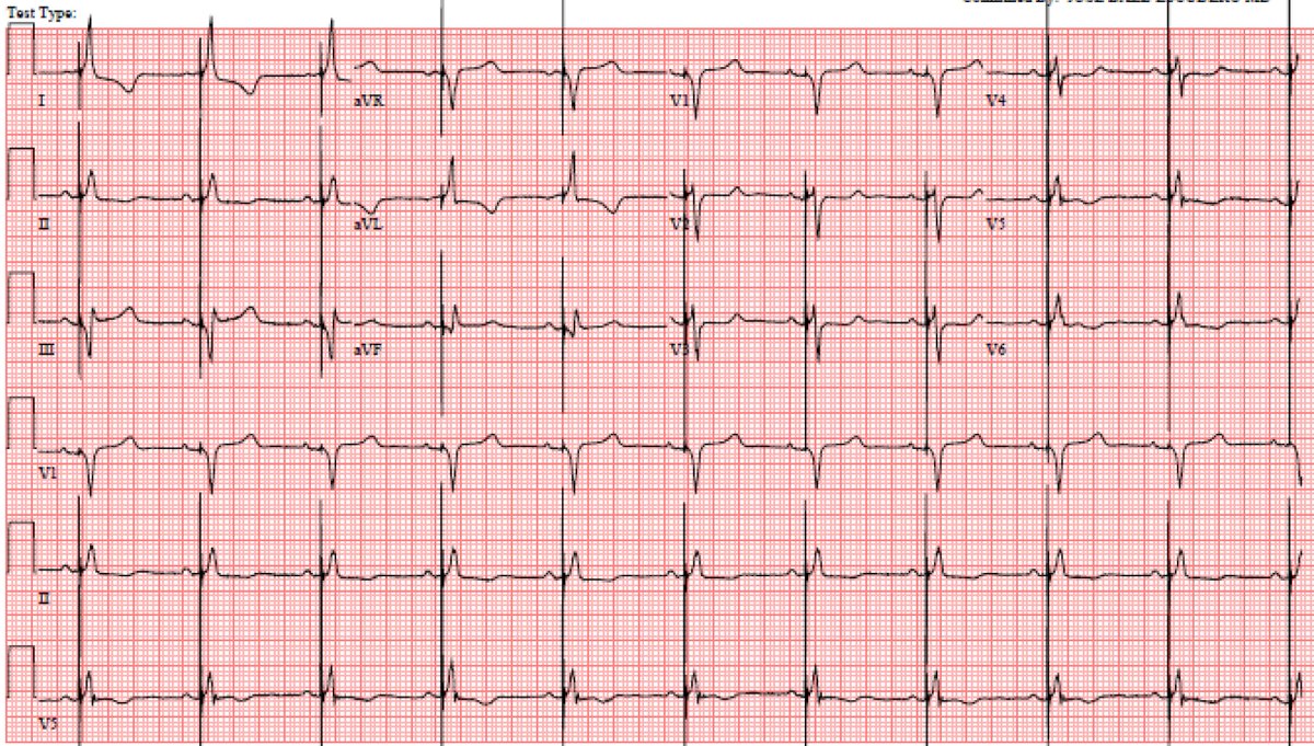 Sergio Pinski tweet media