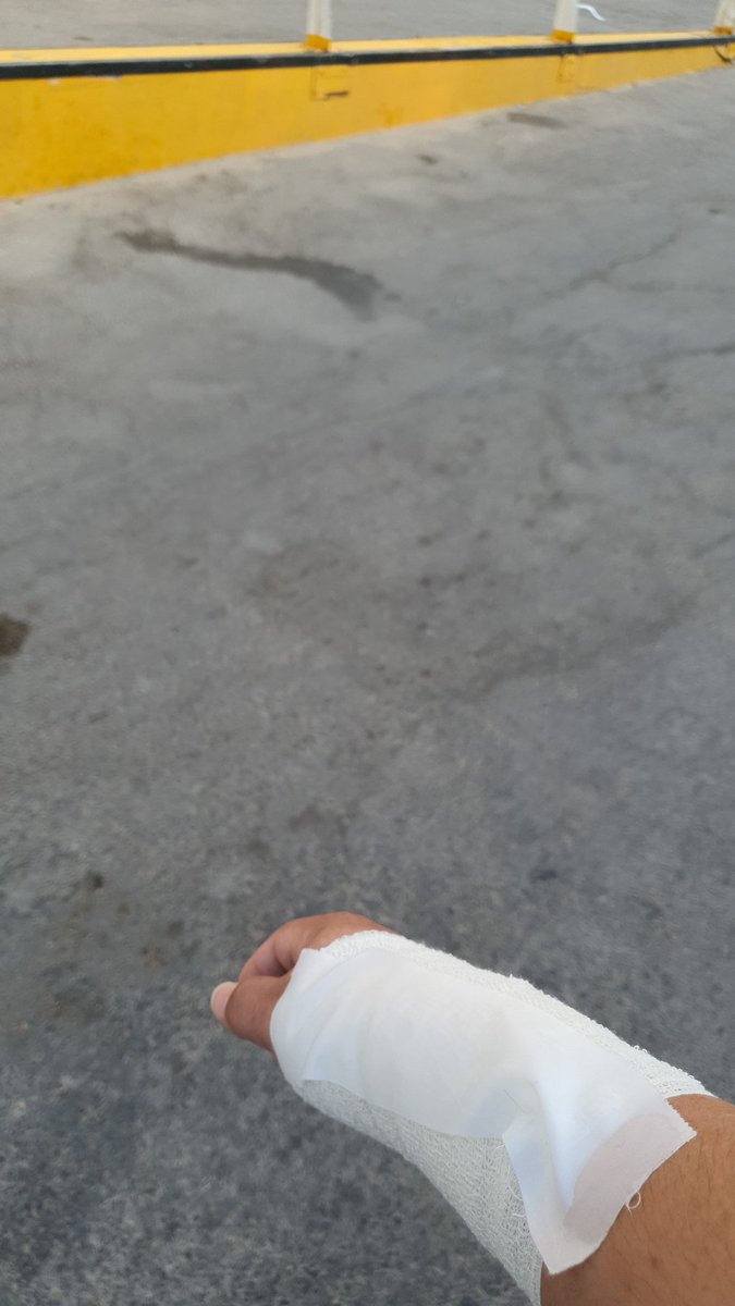 يالله لك الحمد تمت العمليه على خير و اقدر ارجع للروتين الطبيعي بدون مشاكل 🤝🏻