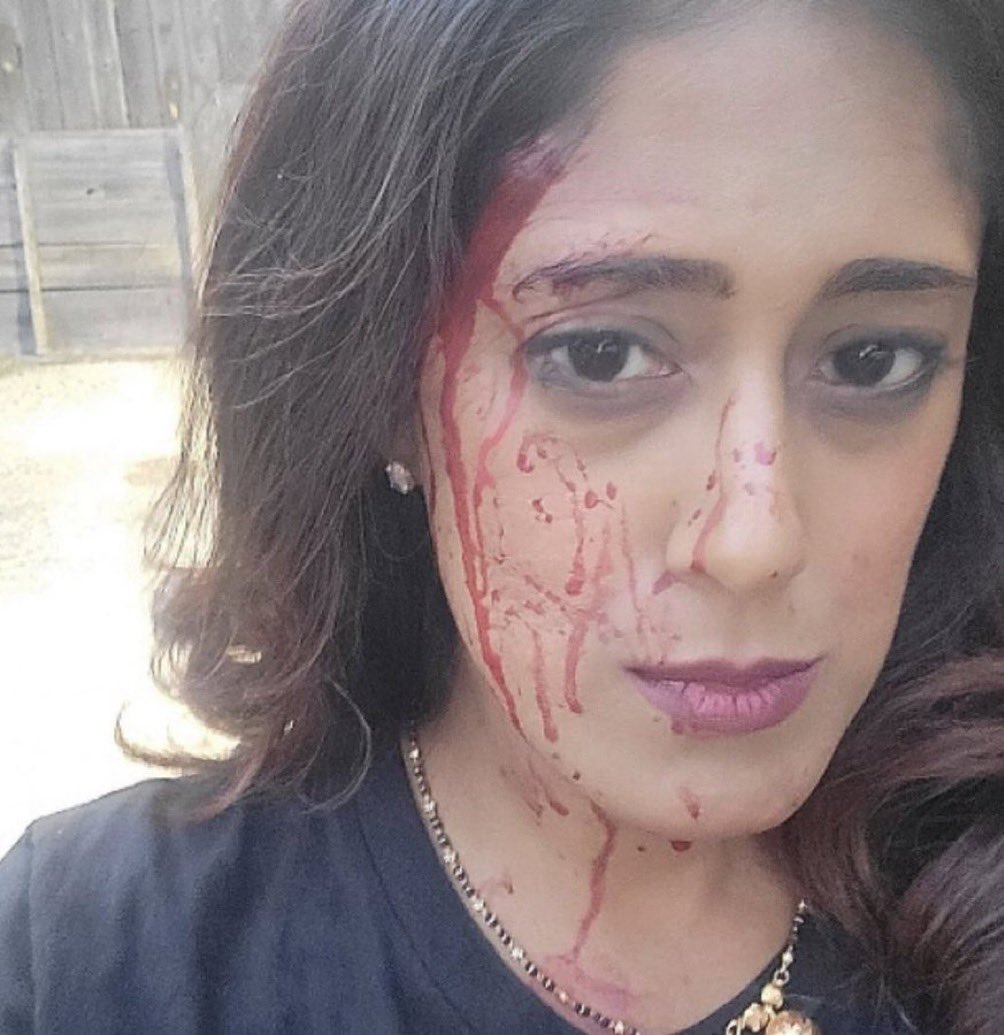 I’ll respond here instead of the DMs. This my professional opinion. 14 years law enforcement, detective course, homicides etc. 

This is absolutely in my “Opinion” fake blood. It’s not consistent from alot of assaults I’ve investigated. The blood pattern is off, hair with the