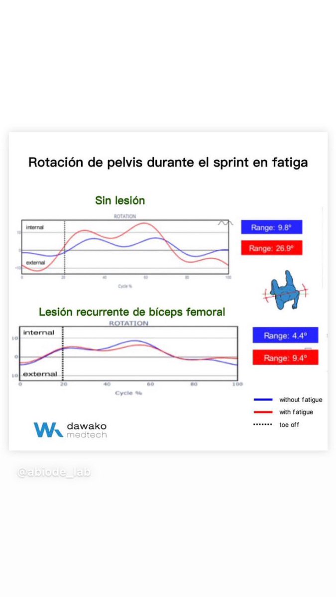 ¿Cómo es la rotación de pelvis durante el sprint para prevenir la lesión de isquiotibiales?:  
👉 debe incrementar el rango dinámico con la velocidad.  
👉debe aumentar la rotación externa en el apoyo para aumentar la absorción. 
#I+D #wearables #football #prevention #Dawako