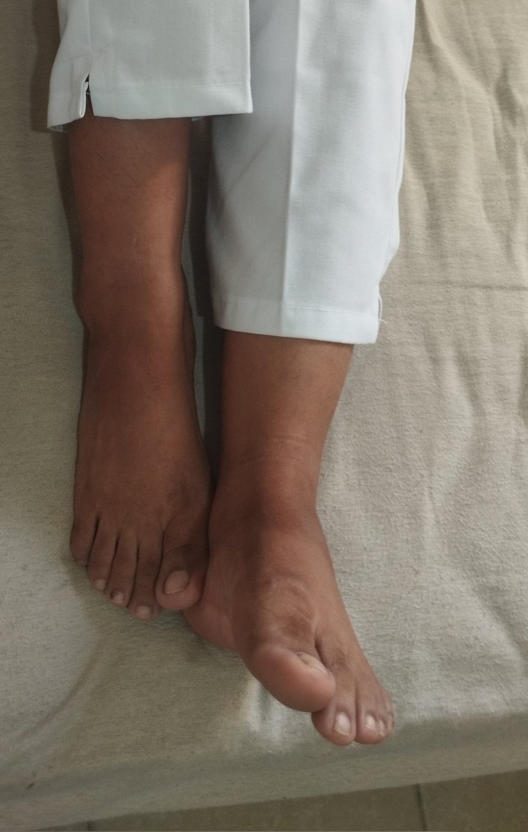 Kissany94's tweet photo. Los Strong woman Feet de #Dinamita 🧨❤️🫦🤫👣 quieres probarlos? 🥵🔥😏
Pregunta por nuestros paquetes y promociones 🥵
#feetfinder #feetfethish #feetpic  #feetcontent https://t.co/v6QcDHJYOJ