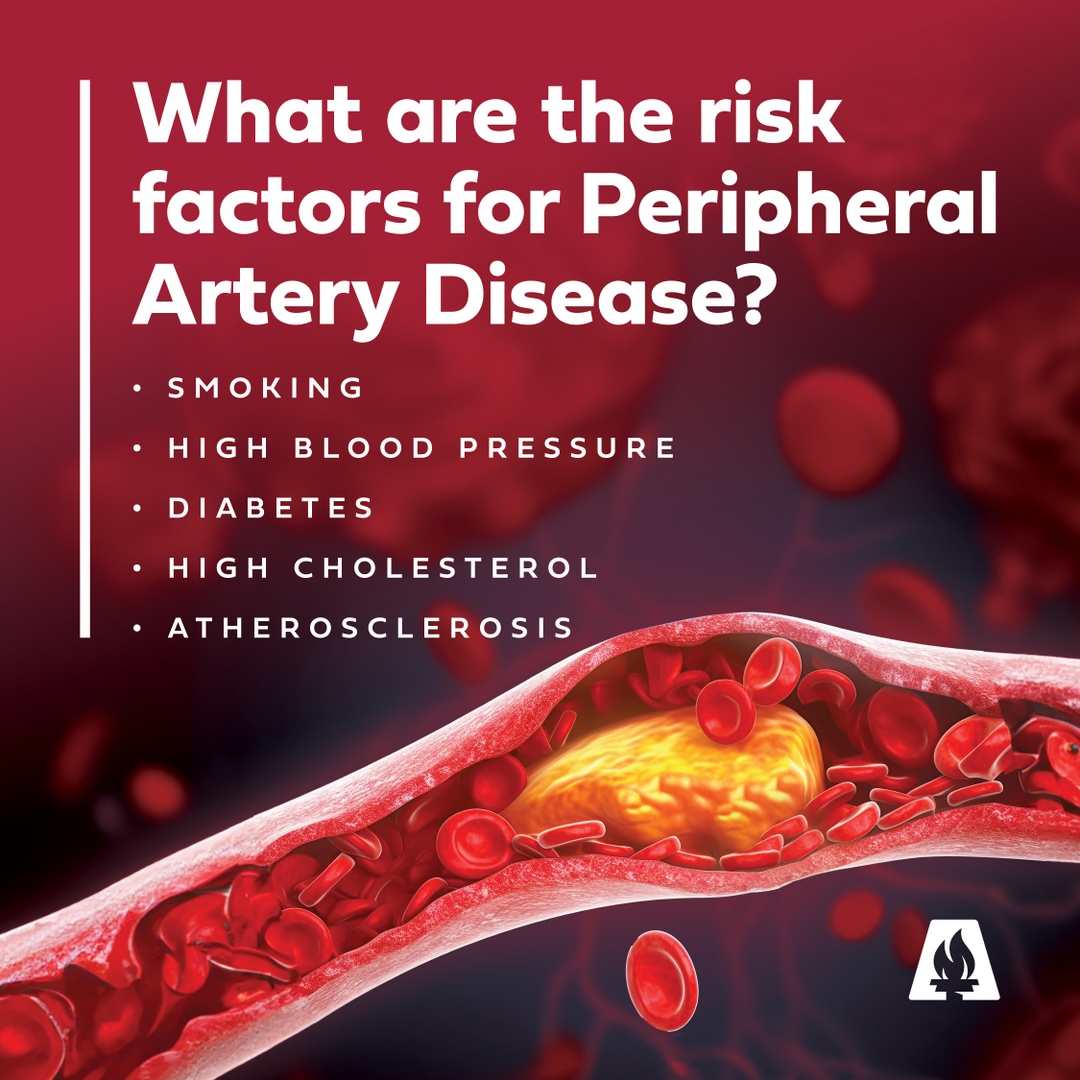 Approximately 6.5 million people above the age of 40 have peripheral artery disease in the U.S. In honor of #PADAwarenessMonth, ask about cardiac care at AMMC – it could be life-saving. bit.ly/3PtkVLS 

#padawarenessmonth