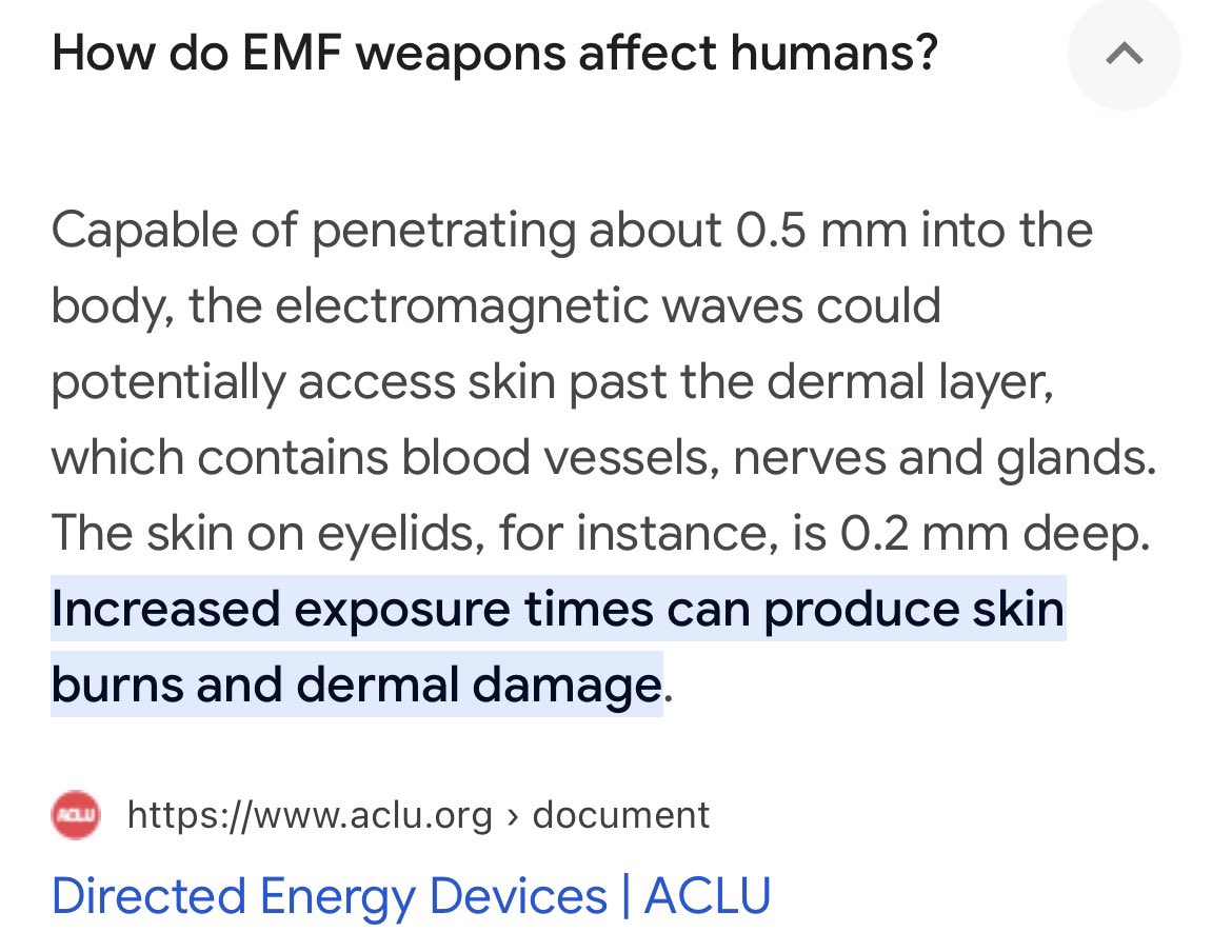 JemisonJaclyn's tweet image. Infrared + concussion grenades + chemical agents + leveling the shit out of all of Putin/Medvedev properties should do the trick. Any dead or dying worth saving would’ve (should’ve) fled by now. #NotImpossible 😄