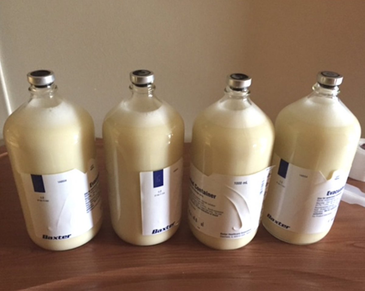 Keith Siau tweet media