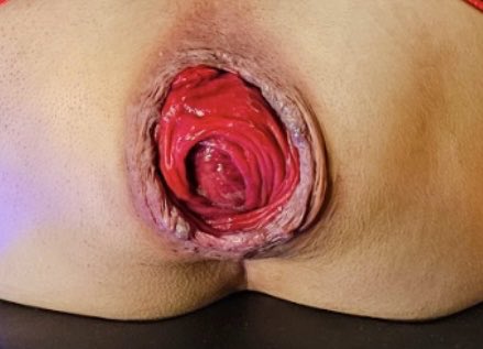 ParchadoMedallo's tweet photo. #gay #gayfun #gaydude #gayman #gaymen #gayguy #gaypornstars #gaybear #gaybeards #gaydaddies #gaybeefy #gayboy #gayboys #gaysa #gaysex #gayporn #gayfollowers #gayfetish #gayfollow #followgay #gayhot #ass #cock #bigass #fuck #dirtybitch #fuckhard #sexhard #orgygay #ass #NowOnAir https://t.co/jXapDbQROk
