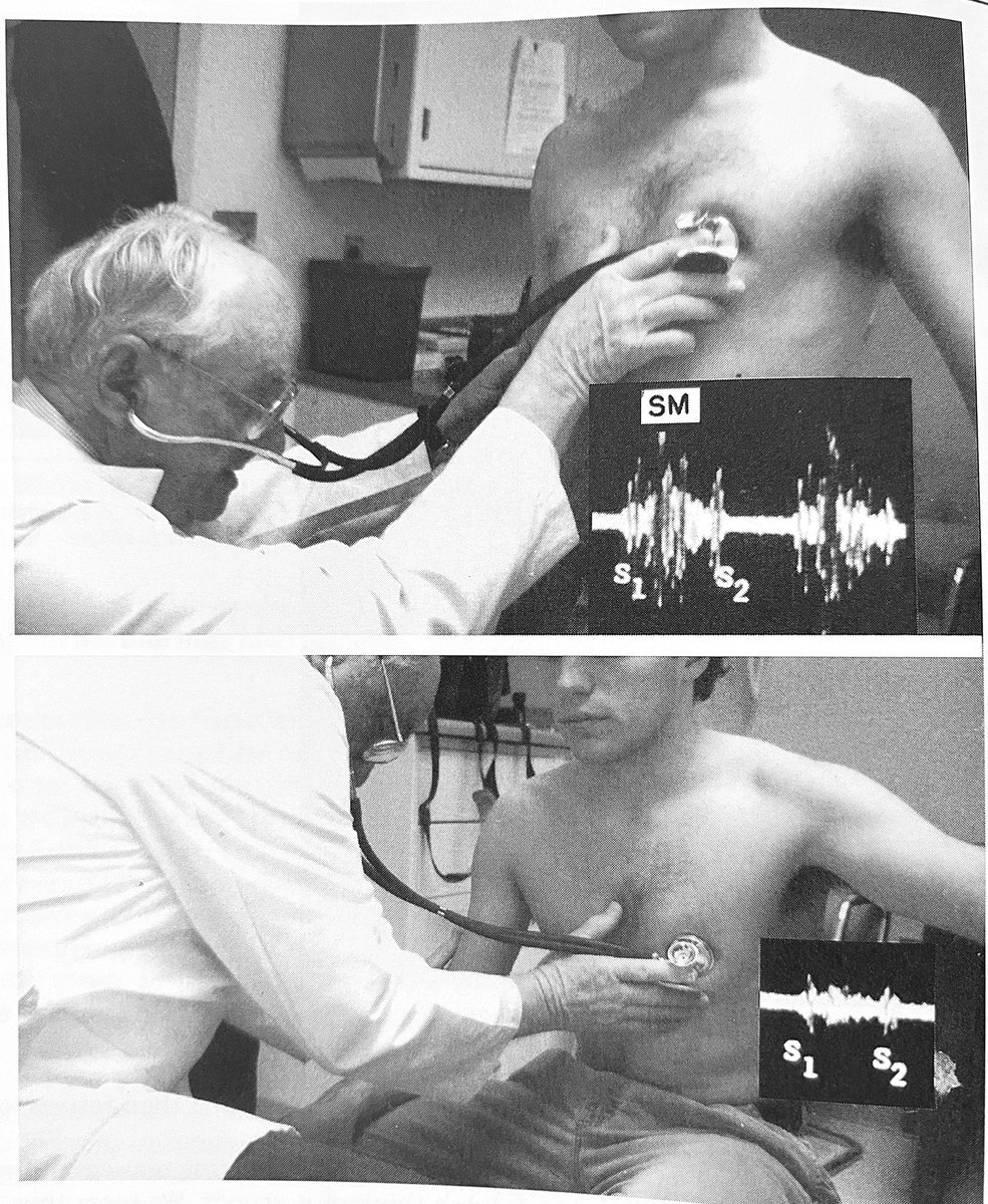 50 years ago, cardiologists were like magicians, diagnosing any cardiac condition by stethoscope and ECG. The old arts are now passe, thanks to malpractice attorneys and better diagnostic equipment. 

Proctor Harvey diagnosing hypertrophic cardiomyopathy by "squatting maneuver."