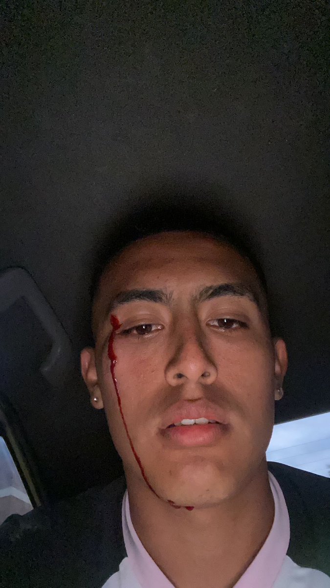 ValeryMezaG's tweet photo. Gente de mierda que no entienden que esto es fútbol, no una película de terror. Estos no son hinchas son delincuentes disfrazados de hinchas. Que bajo han caído que le hagan esto en su propio barrio donde hay barristas del equipo rival. https://t.co/XF1EgwIr2d