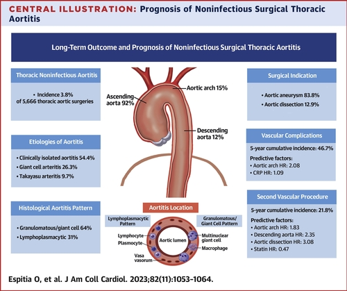 DrWheatley's tweet photo. Original Investigation: Long-Term Outcome and Prognosis of Noninfectious Thoracic Aortitis

https://t.co/PnRozZF27g https://t.co/cQkeeX86Ds