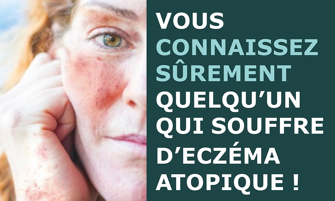 CHUnantes's tweet photo. En France, 2 millions d'adultes et 1,5 million d'enfants souffrent d'eczéma atopique 😲.
📅 13 septembre au CHU de Nantes, journée spéciale de sensibilisation au CHU de Nantes
ℹ️ https://t.co/68GvbllfnE
#ADday #eczema @SFDermatologie @asso_eczema https://t.co/Kfs8p4rhmN