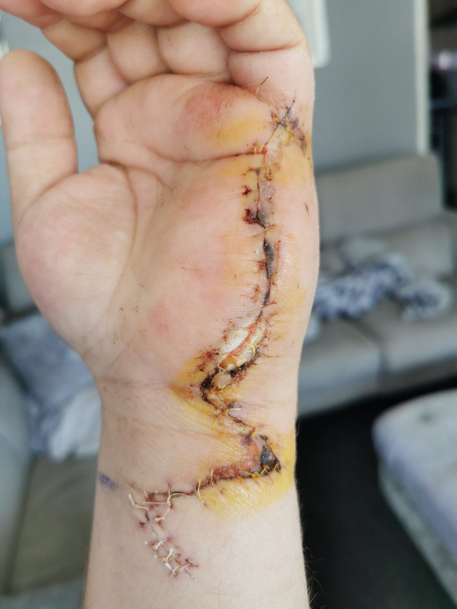 Jedd Roberts tweet media