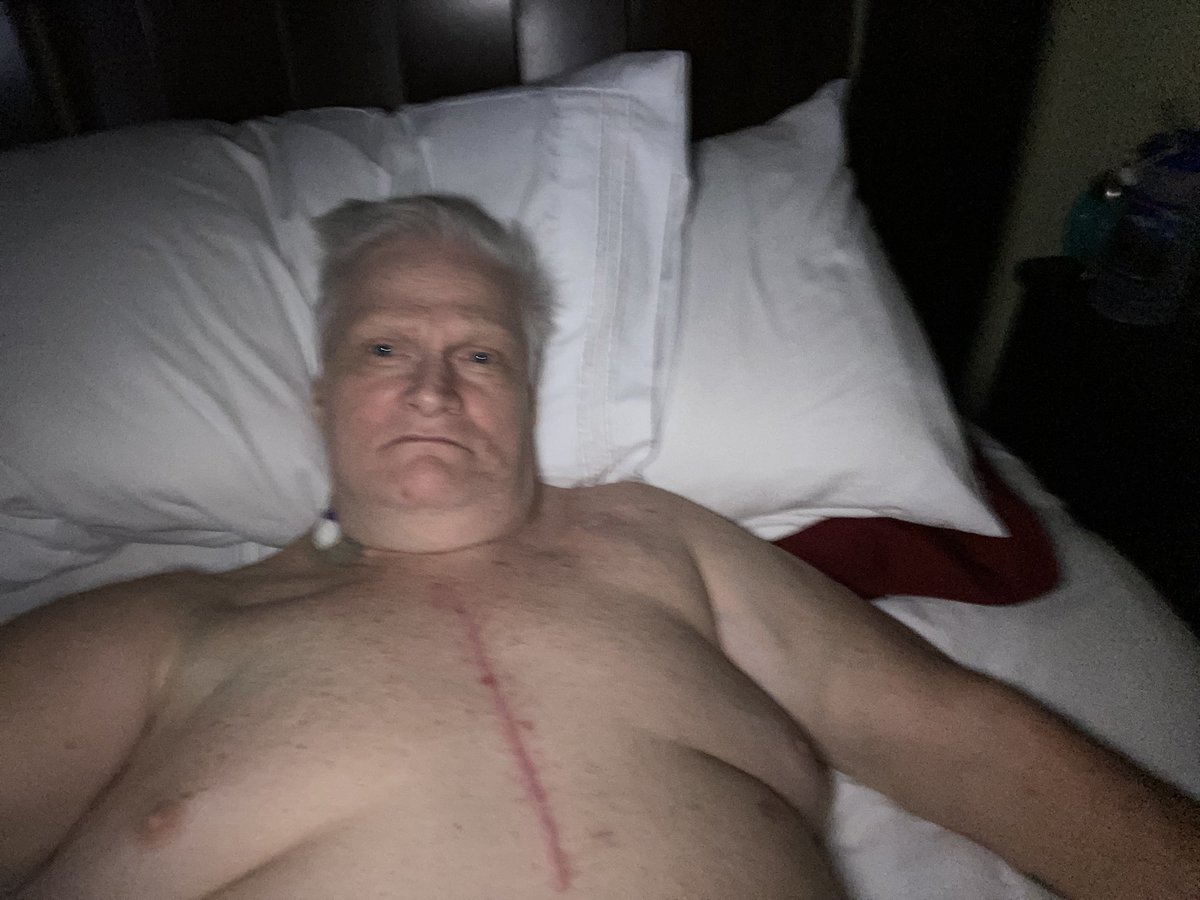 hoskinso6's tweet photo. @Wendy47802703 I had heart failure. I finally had to have surgery to have an LVAD installed. Please ask your doctor to contact Tampa General. https://t.co/tQJ1Qu68PQ