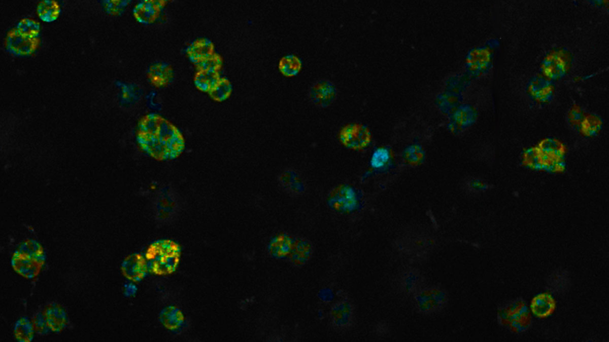 Communications Biology tweet media