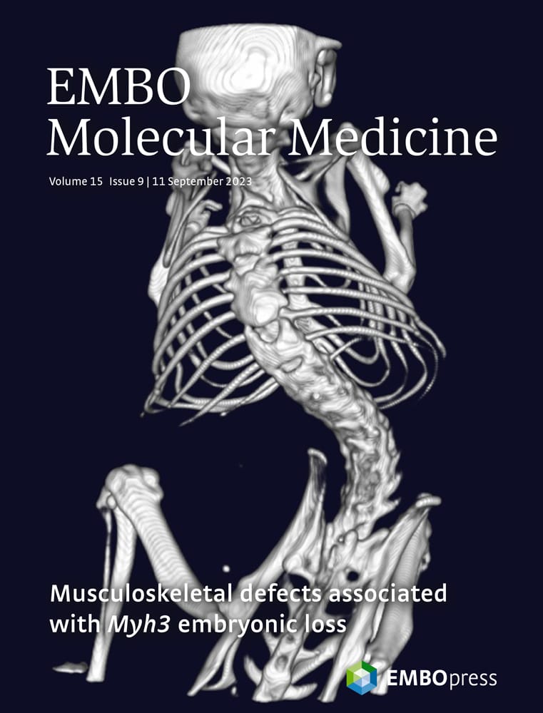 Sam Mathew (@sammathew_rcb) on Twitter photo Thank you <a href="/EmboMolMed/">EMBO Mol. Medicine</a> for featuring our work on the journal cover. Congratulations <a href="/AnushreeBharad5/">Anushree Bharadwaj</a> <a href="/Jaydeep_Sharma_/">Jaydeep Sharma</a> <a href="/MahimaK2104/">Mahima Kumari</a> <a href="/TanushriDargar/">Tanushri Dargar</a> <a href="/bhargab76/">Bhargab Kalita</a> Thanks to <a href="/unescorcb/">RCB</a> <a href="/DBTIndia/">Department of Biotechnology</a> <a href="/India_Alliance/">DBT/WT India Alliance</a> <a href="/rajesh_gokhale/">Rajesh Gokhale</a> Thank you <a href="/EmboMolMed/">EMBO Mol. Medicine</a> for featuring our work on the journal cover. Congratulations <a href="/AnushreeBharad5/">Anushree Bharadwaj</a> <a href="/Jaydeep_Sharma_/">Jaydeep Sharma</a> <a href="/MahimaK2104/">Mahima Kumari</a> <a href="/TanushriDargar/">Tanushri Dargar</a> <a href="/bhargab76/">Bhargab Kalita</a> Thanks to <a href="/unescorcb/">RCB</a> <a href="/DBTIndia/">Department of Biotechnology</a> <a href="/India_Alliance/">DBT/WT India Alliance</a> <a href="/rajesh_gokhale/">Rajesh Gokhale</a>