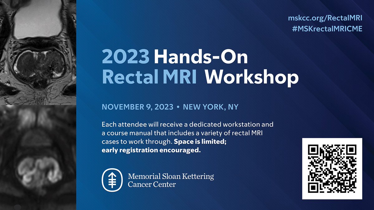SAR_DFP_RECTALANAL (@sardfprectal) on Twitter photo It’s that time of the year again! Spread the word as the registration for MSKCC world famous rectal MRI hands on workshop is now open! <a href="/marc_gollub/">marc gollub</a> <a href="/Iva_Petkovska_5/">Iva Petkovska MD FSAR</a> <a href="/MariaElHomsi3/">Maria El Homsi</a> <a href="/VParoder/">Viktoriya Paroder MD PHD FSAR</a> and other experts to teach and share their expertise with you! It’s that time of the year again! Spread the word as the registration for MSKCC world famous rectal MRI hands on workshop is now open! <a href="/marc_gollub/">marc gollub</a> <a href="/Iva_Petkovska_5/">Iva Petkovska MD FSAR</a> <a href="/MariaElHomsi3/">Maria El Homsi</a> <a href="/VParoder/">Viktoriya Paroder MD PHD FSAR</a> and other experts to teach and share their expertise with you!