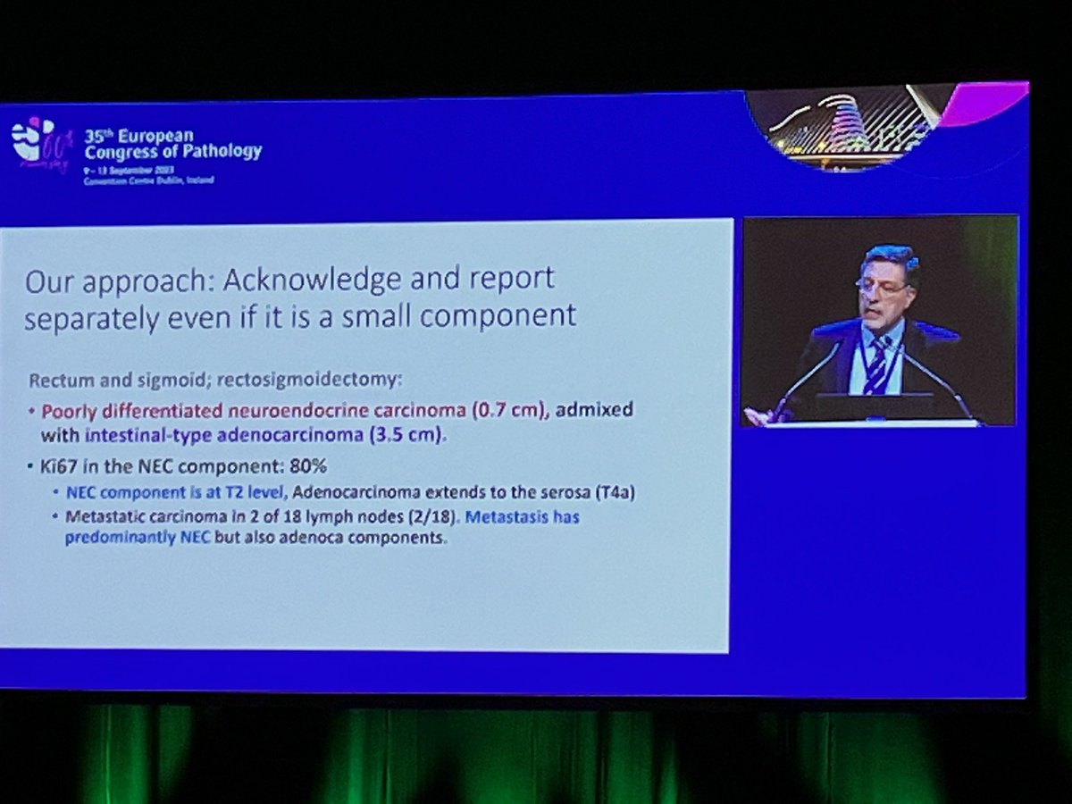 Trupti2410's tweet photo. #GITNEUROENDOCRINE tumours …
Points to mention in #MINEN
#ECP23 ..talk by Volkan Adsay https://t.co/VfHWLKNudU