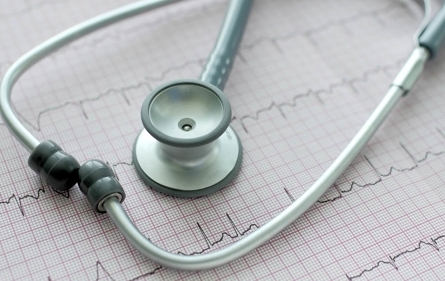 What exactly is atrial fibrillation (AFib), and should you be worried about it? Learn more: griswoldhomecare.com/blog/2023/janu…