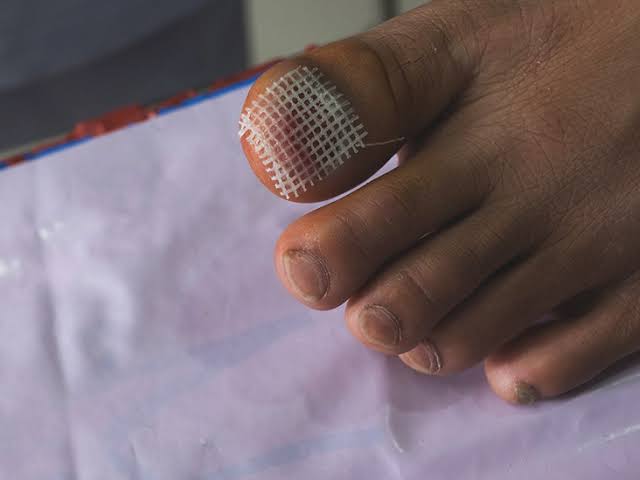 Nig_Farmer's tweet photo. #NaijaFarmerTips
Do you have a open cut/wound, Body scratch you don't want infected, or children open wounds  

And you want it HEALED FAST!

Slice onions and rub around / on the wound or squeeze Onion Juice on it

it's an antiseptic against germs

Also Heals your wounds Fast! https://t.co/r1kgRamjQK
