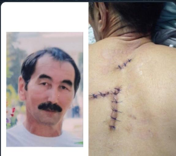 rasshalina's tweet photo. In #Semey, the Akimat came to a meeting of civil activists &amp; opinion leaders to shoot under the pretext of fighting marauders. Human rights activist Aliya #Isenova (@Elimay_kz ) was wounded, Daulet #Mukhazhanov became disabled,arrested people died from cruel torture, @NeilBushUK https://t.co/XLaqDWBxhH