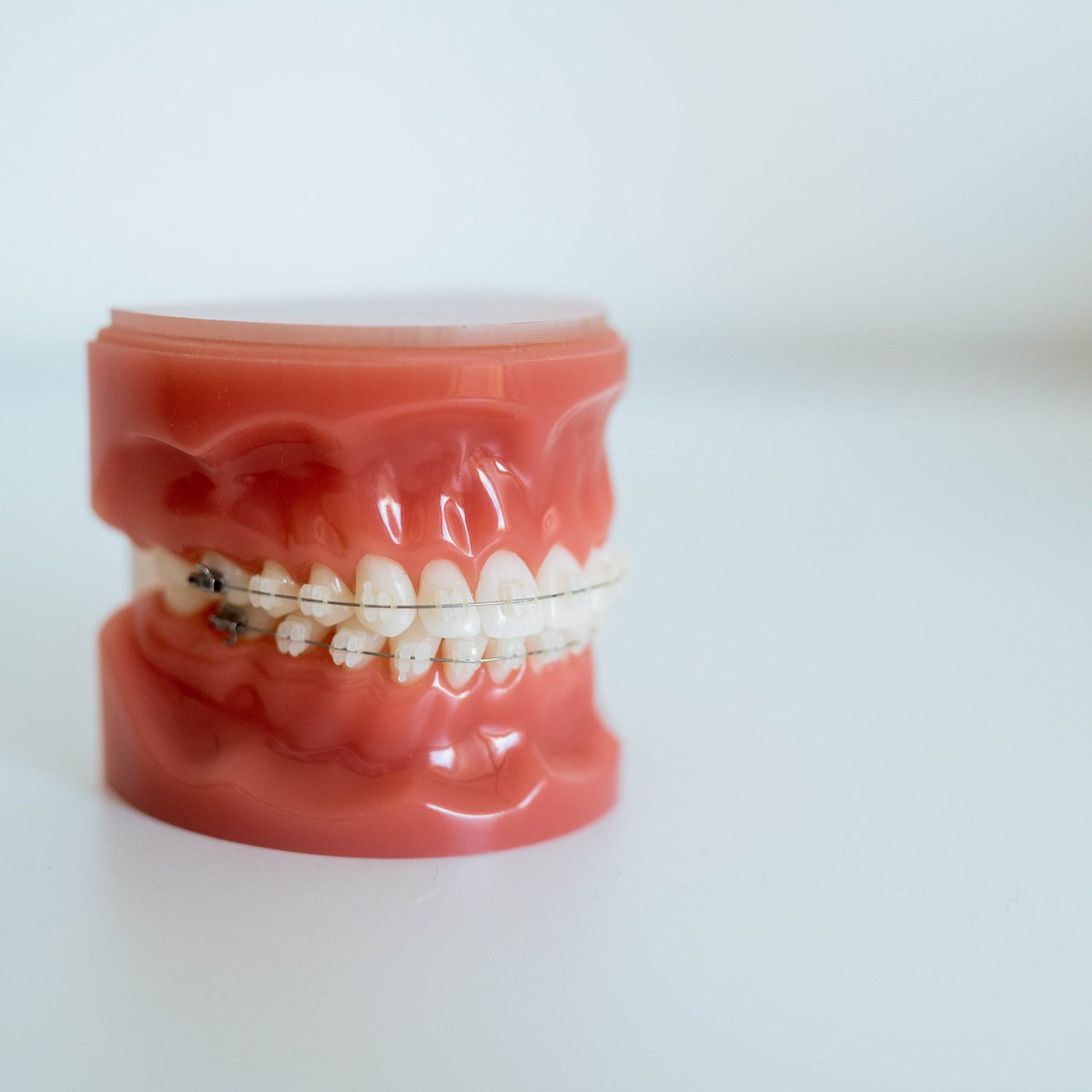 Are you ready to take the leap and get that smile makeover you’ve always dreamed of?! 🤔

Let Wearside Orthodontic Centre be your go-to for all your things orthodontic needs! From removable to fixed appliances, we’ve got you covered! 😁

#Orthodontics #FixedAppliance #Braces