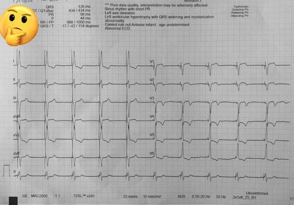 Ugur Canpolat tweet media