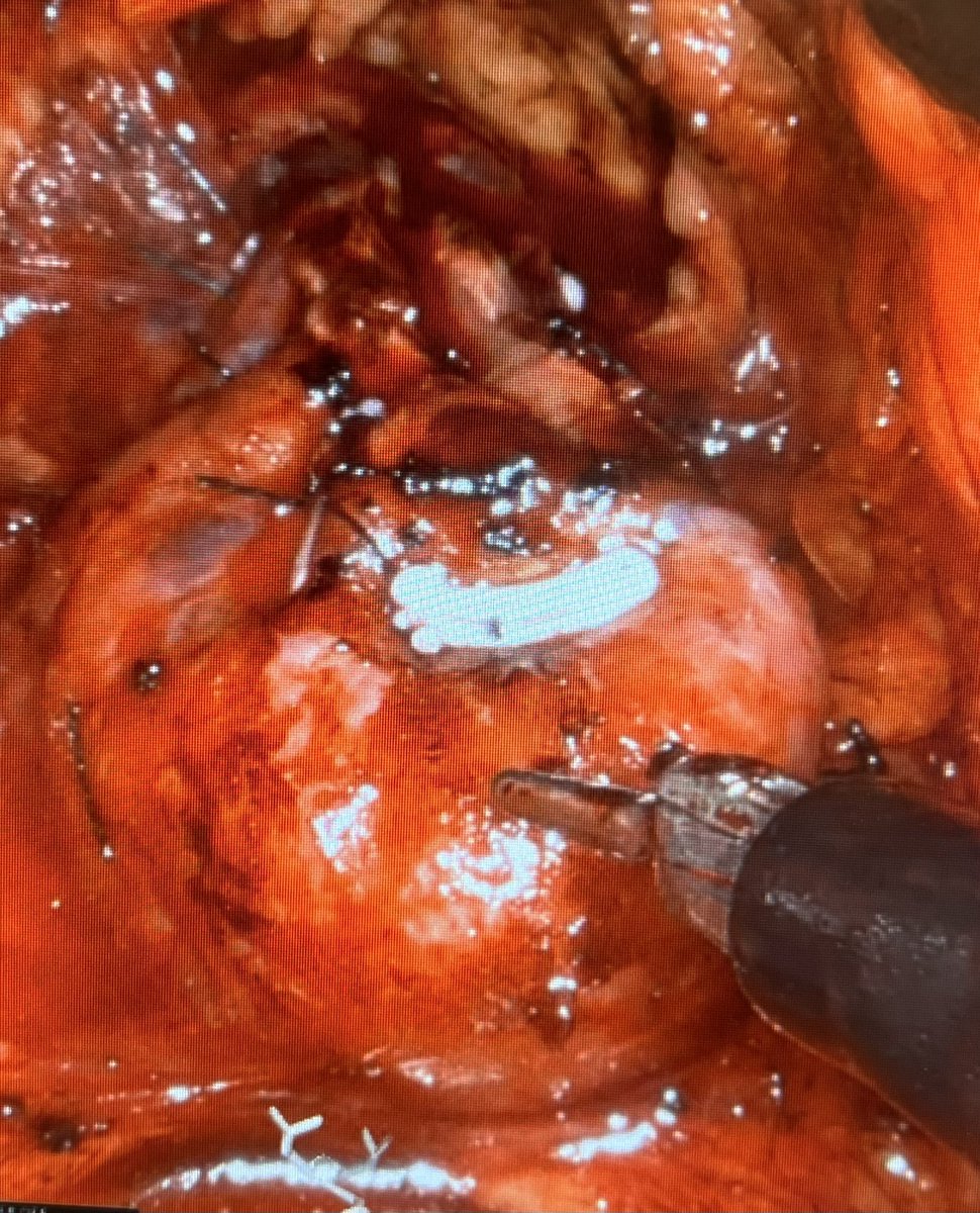 Michael Stifelman tweet media