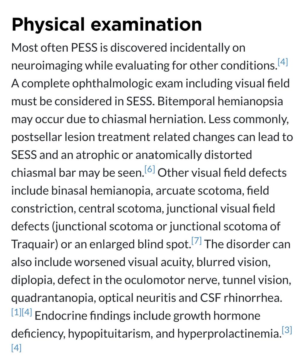 Empty sella: Vision disturbances
<a href="/DrMollan/">Dr Susan Mollan</a> <a href="/fightforsightUK/">Fight for Sight</a> <a href="/medicalinfo0/">Dr.Hamza</a> <a href="/novelnanos/">NOVEL (Neuro-Ophthalmology Virtual Ed. Library)</a> <a href="/Pituitary_org/">The Pituitary Foundation</a> <a href="/RCOphth/">Royal College of Ophthalmologists</a> <a href="/RNIB/">RNIB</a>
