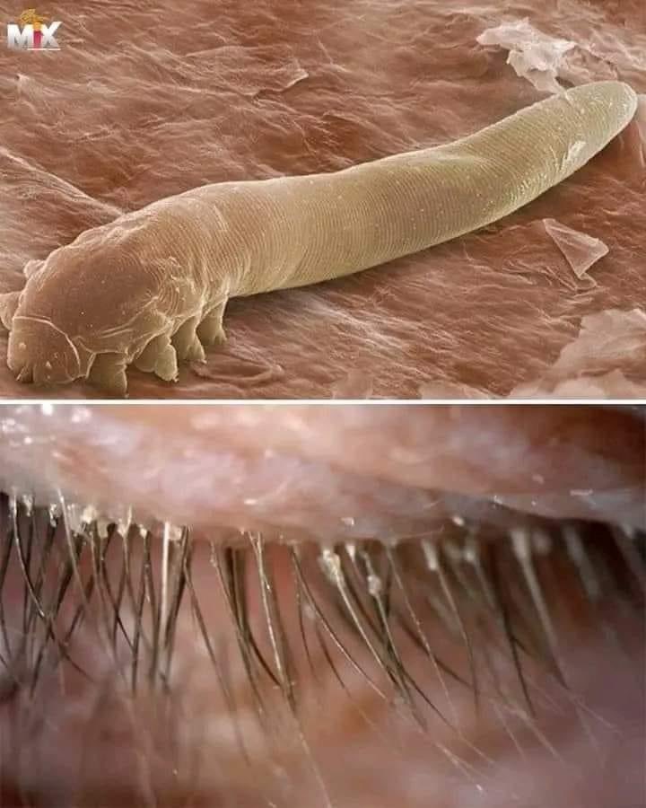 This cute creature called the mite lives inside your eyelashes. It comes out at night while you are sleeping to walk on your face. Its males and females perform mating and fertilization on your face. The females lay between 20 to 24 eggs inside each hair follicle of your