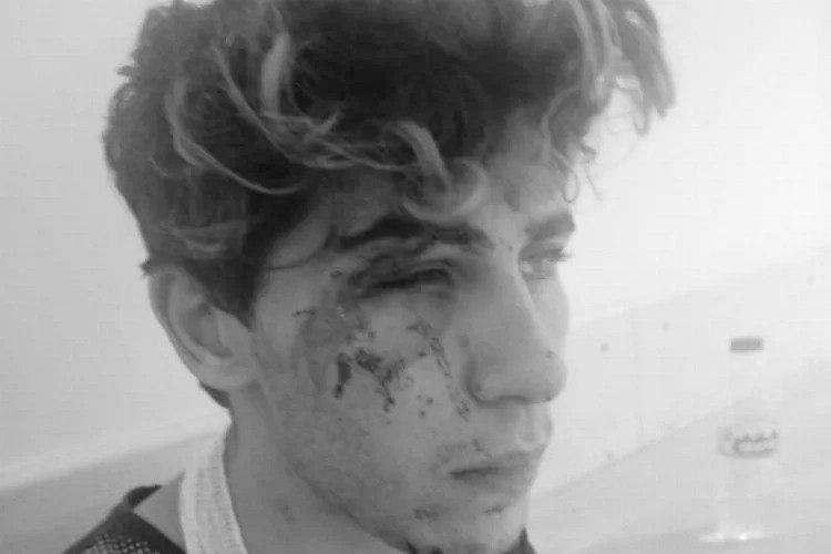 Bursa'da bir gencin, kalabalık bir Suriyeli grubu tarafından silahla darp edilip, işkence altında ayaklarının öptürüldüğü olayın sosyal medyaya düşmesi sonrası tüm ajanslar aynı haberi geçmeye başladı "2 Suriyeli tutuklandı."
Tamamen algı operasyonu.
2 Suriyeli 7 Eylül 2023'te