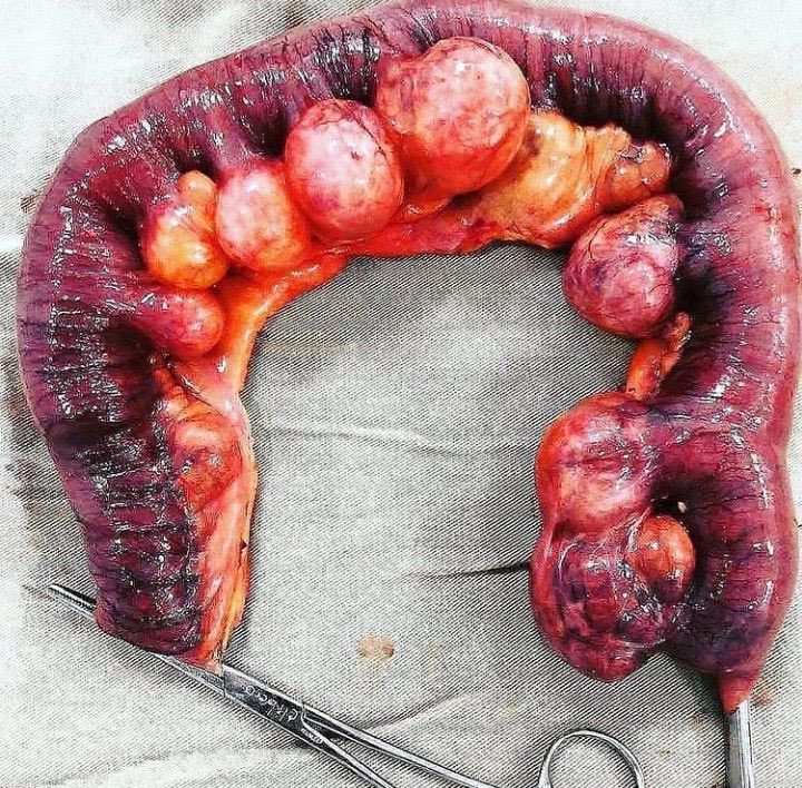 Keith Siau tweet media