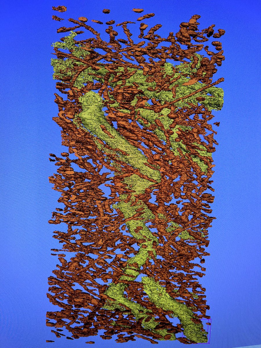 Craig Daly (@craigjdaly) on Twitter photo A 10Gb volume of mitochondria (brown) segmented from a block of EM data.  The processing (using machine learning) was done on the <a href="/UofGMVLS/">UofG MVLS</a> Advanced Research System (MARS).  Having an account on MARS just feels kinda cool.  Follow me for more pictures from MARS 👽 A 10Gb volume of mitochondria (brown) segmented from a block of EM data.  The processing (using machine learning) was done on the <a href="/UofGMVLS/">UofG MVLS</a> Advanced Research System (MARS).  Having an account on MARS just feels kinda cool.  Follow me for more pictures from MARS 👽