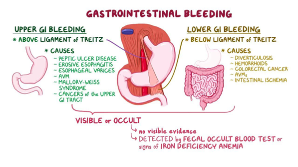 4) Unfortunately, despite their excellent safety profile, #DOACs can increase the risk of bleeding, the most life-threatening of which is intracranial #hemorrhage #ICH and the most common is #gastrointestinal #GIB, both upper #UGIB and lower #LGIB