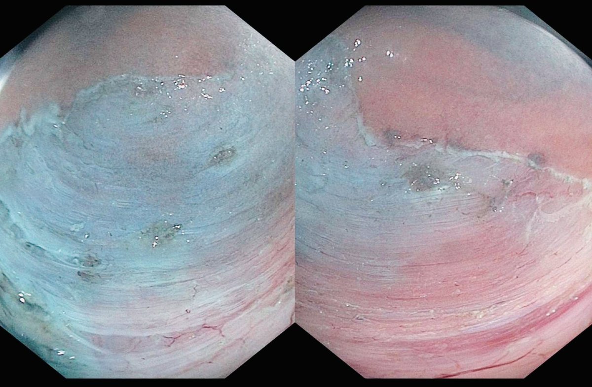 Antonio Cheesman, MD tweet media