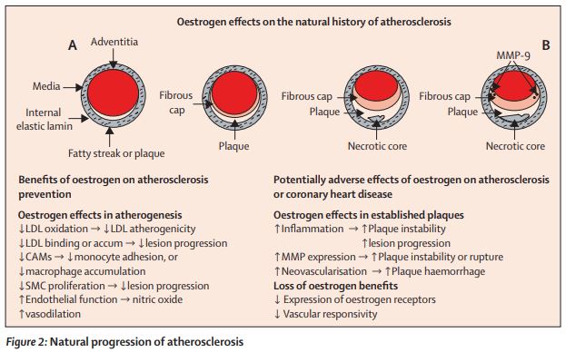 TheLancetEndo's tweet photo. When instituted early, which is key, in younger #postmenopausal women (under 60 years) #oestrogen has been found to consistently decrease mortality with a favourable risk–benefit profile in low-risk women https://t.co/5JIQVhO8mZ 
#Menopause #WomensHealth https://t.co/Ai19Y5kXad