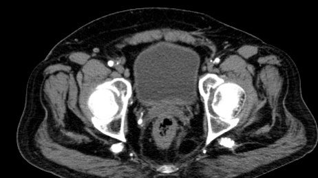 Karan Anandpara tweet media