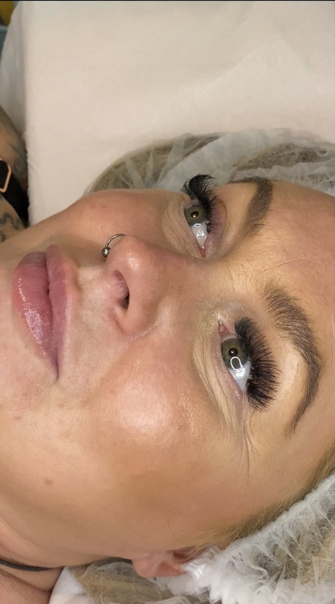 This is me at the very start of
My “Vampire Facial” this Evening. This involves taking my blood, spinning it and micro needling the plasma back into my skin. Supposed to help with even skin tone, fine lines and wrinkles…. We shall see!! Was very comfortable not at all painful!!