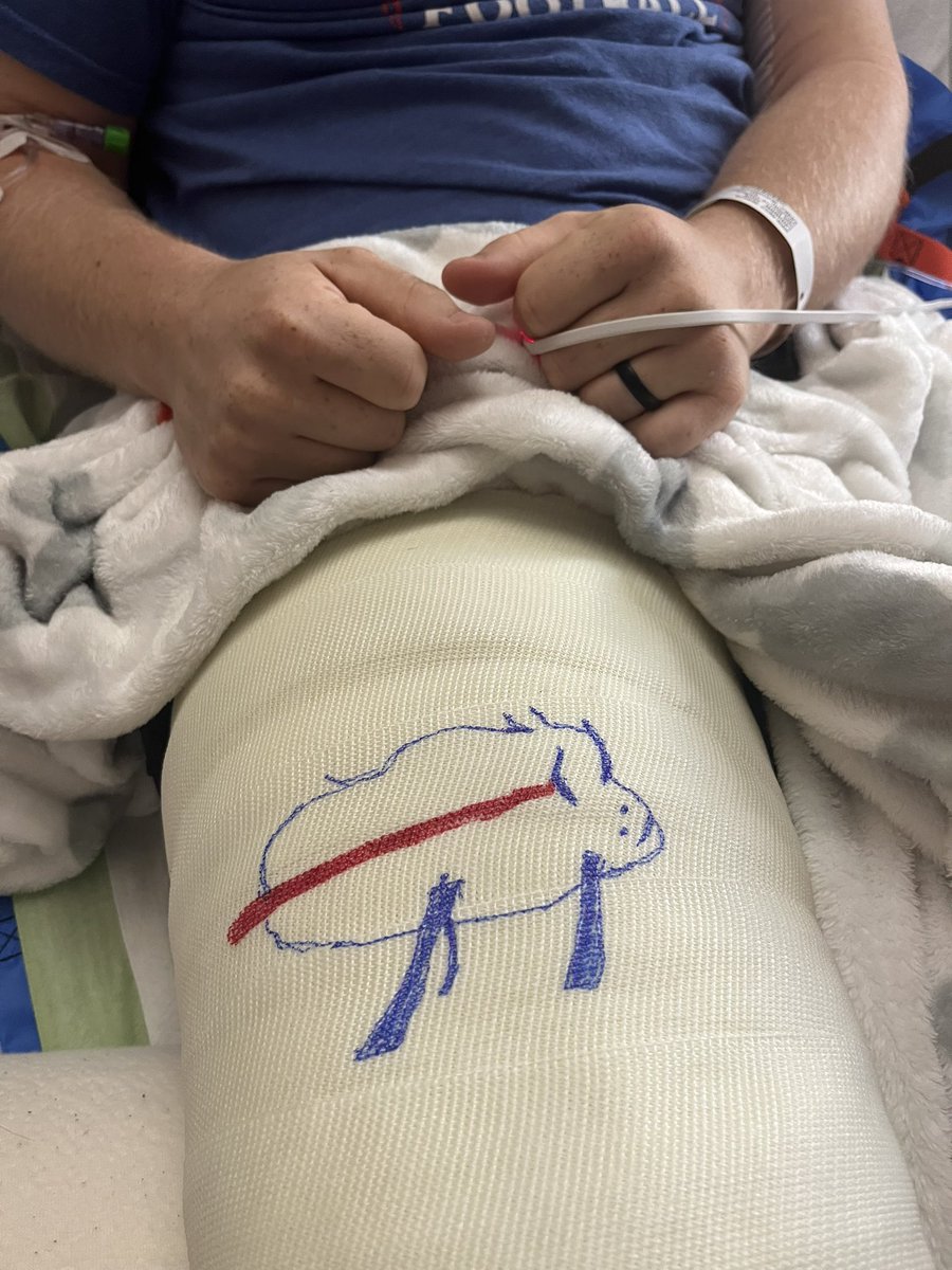 IanLangdon15's tweet photo. Hey @JoshAllenQB this is my boy Jack’s @jacklangdon58 full-leg cast! How’d we do? #Billsmafia https://t.co/nr7tIfeM6B