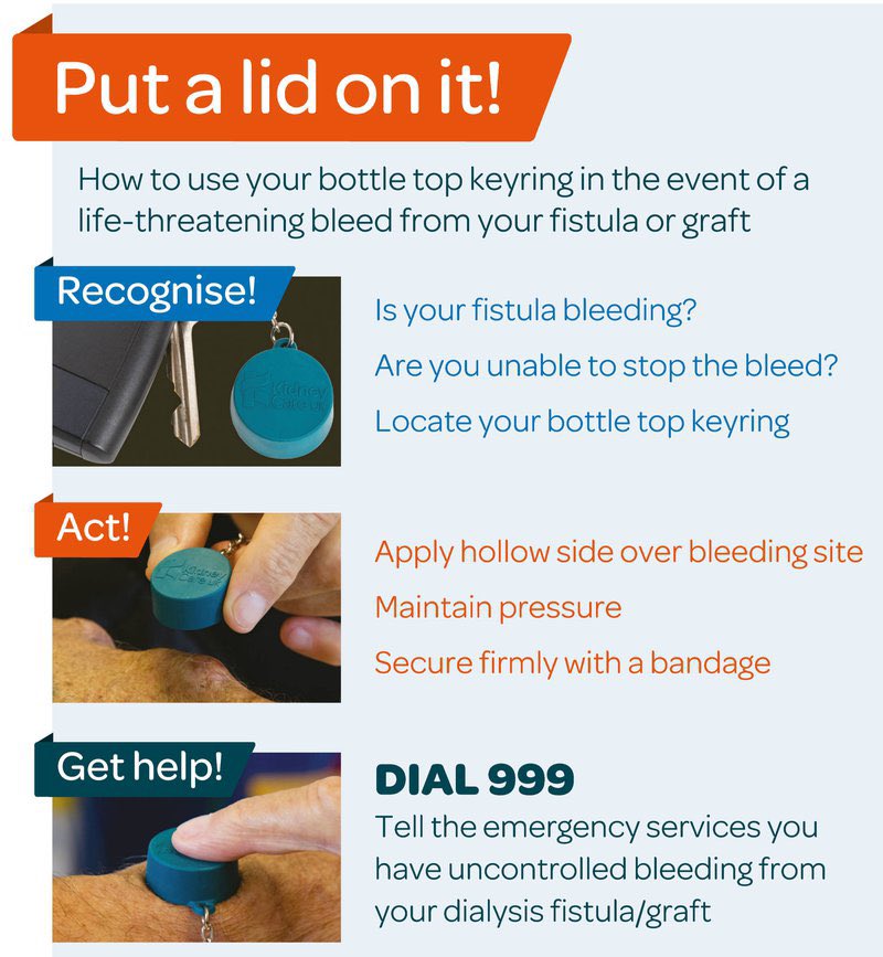 Today I attended a patient bleeding from an arterio-venous (AV) fistula. Although it’s not the commonest of calls for ambulance service, it’s the second in 2 months for me. A potentially life threatening bleed and treated as pictured. Tip: A lid from a sample pot (unused) is