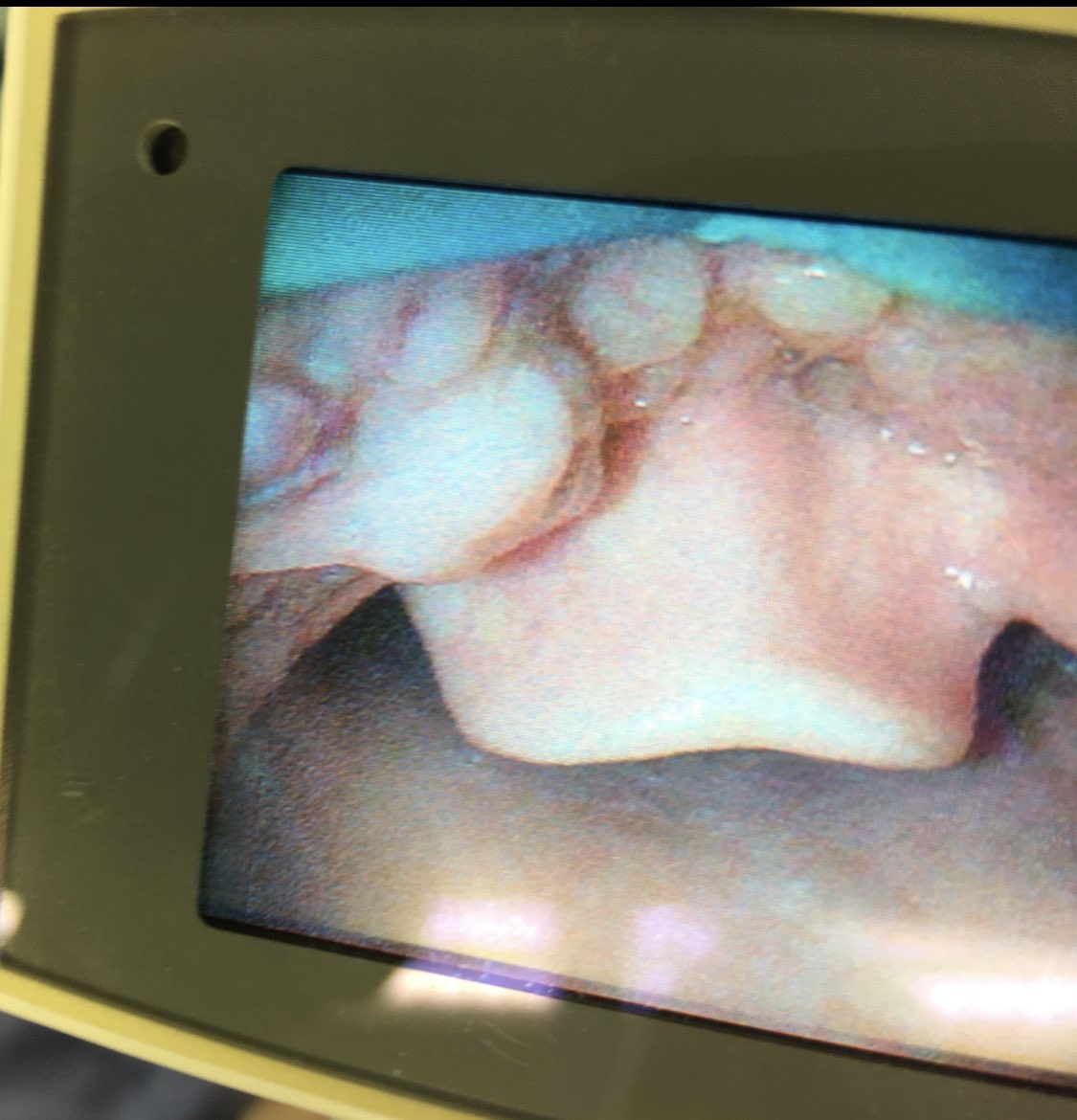 Hans Huitink tweet media