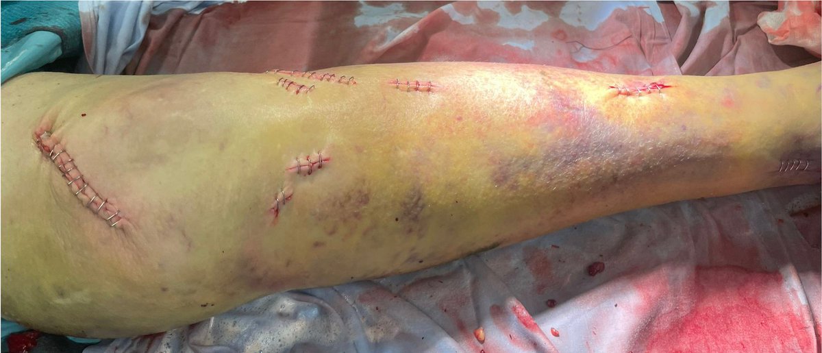 Dr. Diego López tweet media