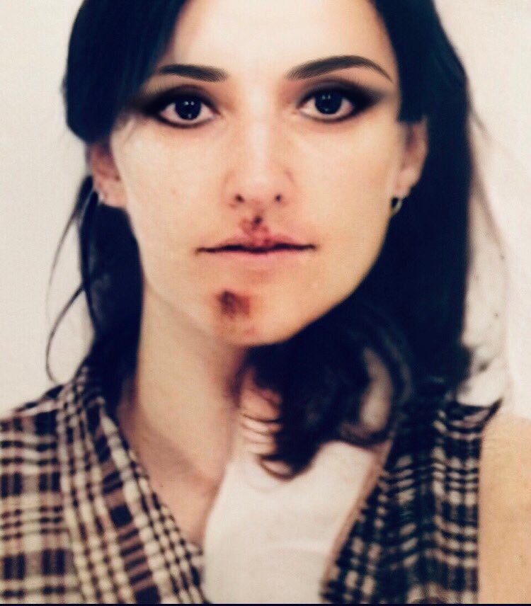 poye_coco's tweet photo. Tu ai une guerrière disent ils. 
Non. Je suis juste tout bonnement traumatisée ! Il m’a démoli. Il ne m’a pas rendu plus forte. Il m’a juste donné envie de mourir. La justice n’a rien fait !!! Classée sans suite !!! 🥲🥲 c’est ça la justice !!! On est seule !!! https://t.co/EFJrl2nNYI