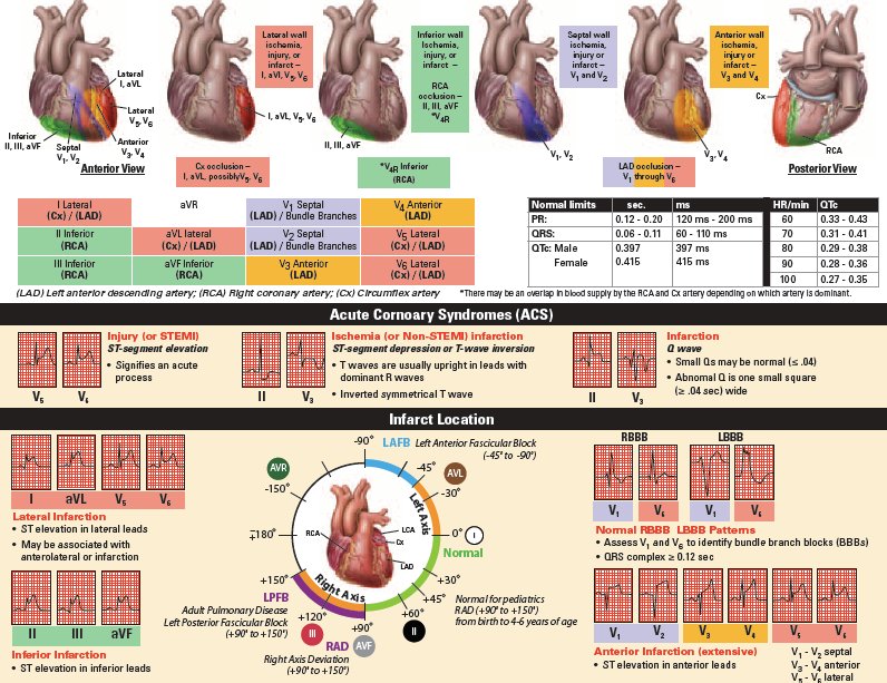 medictests's tweet photo. Nice ECG quick reference! https://t.co/DBhsdkJ6nU