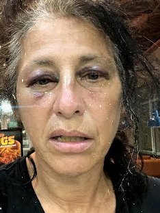 This is what a survivor looks like... When forced to make  decisions because of the ignorance of others<a href="/tag/chicago"class="tags"><span>#chicago</span></a>