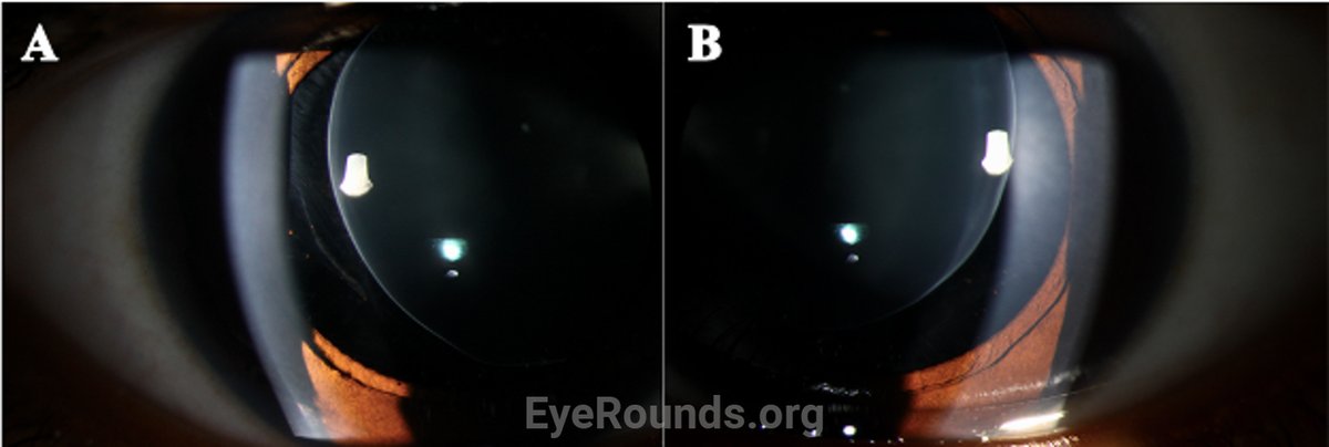 EyeRounds tweet media