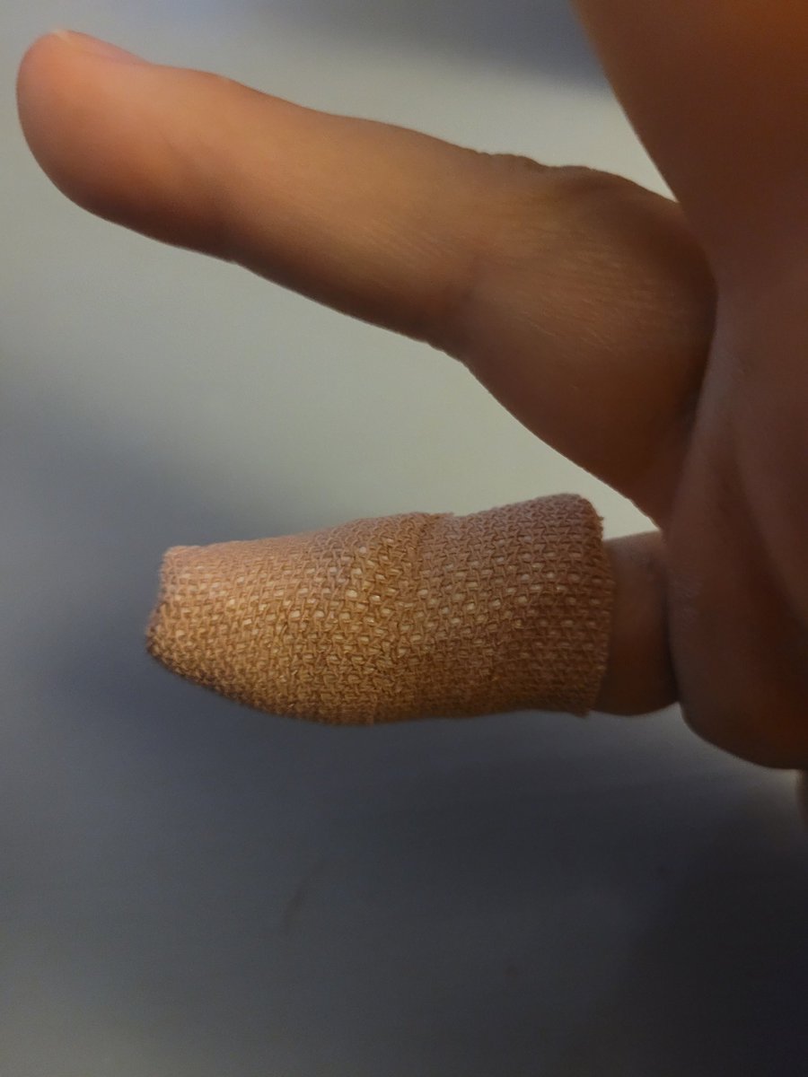 hreeve9's tweet image. 3 weeks in.. Dislocated and broken knuckle and torn ligament. 6 more weeks full time in the splint. Then 4 weeks of weaning it off upping it by 10 minutes a day. Who said netball was non contact 🤣 #missingnetball