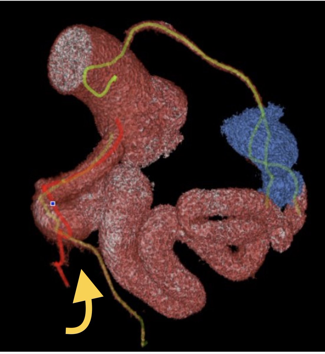 Akram Kawsara tweet media