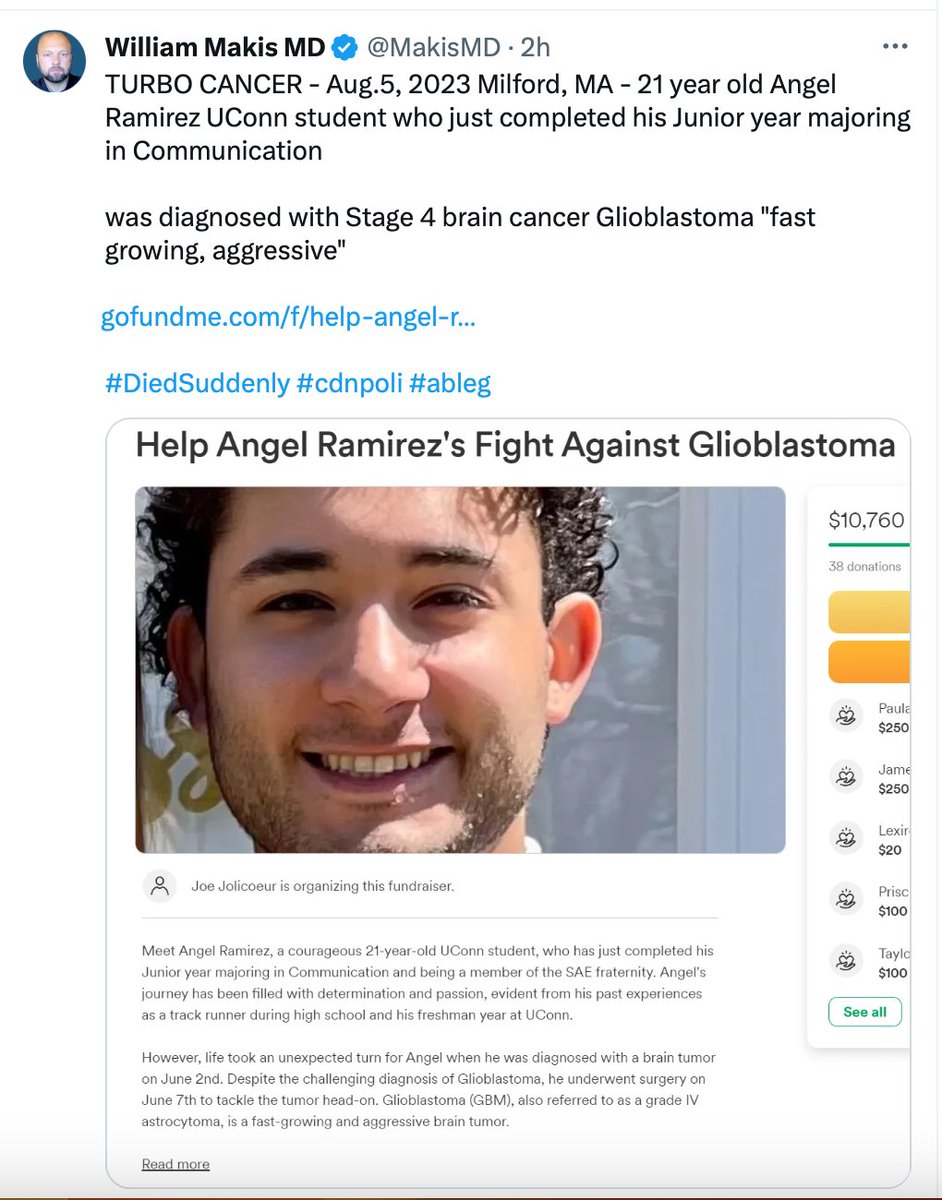 janiesaysyay's tweet image. 06/23 21 yr old, Stage IV Glioblastoma &amp;gt;
#CorrelationNotCausation