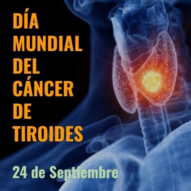 cabeza_cuello's tweet photo. El 24 de setiembre se conmemora el día mundial del cáncer de tiroides. El objetivo de esta fecha es dar a conocer esta importante enfermedad, que  requiere un diagnóstico precoz y un tratamiento oportuno.
#cirujanodecabezaycuellocaracas #cirujanodetiroidescaracas https://t.co/lu97CWrmJA