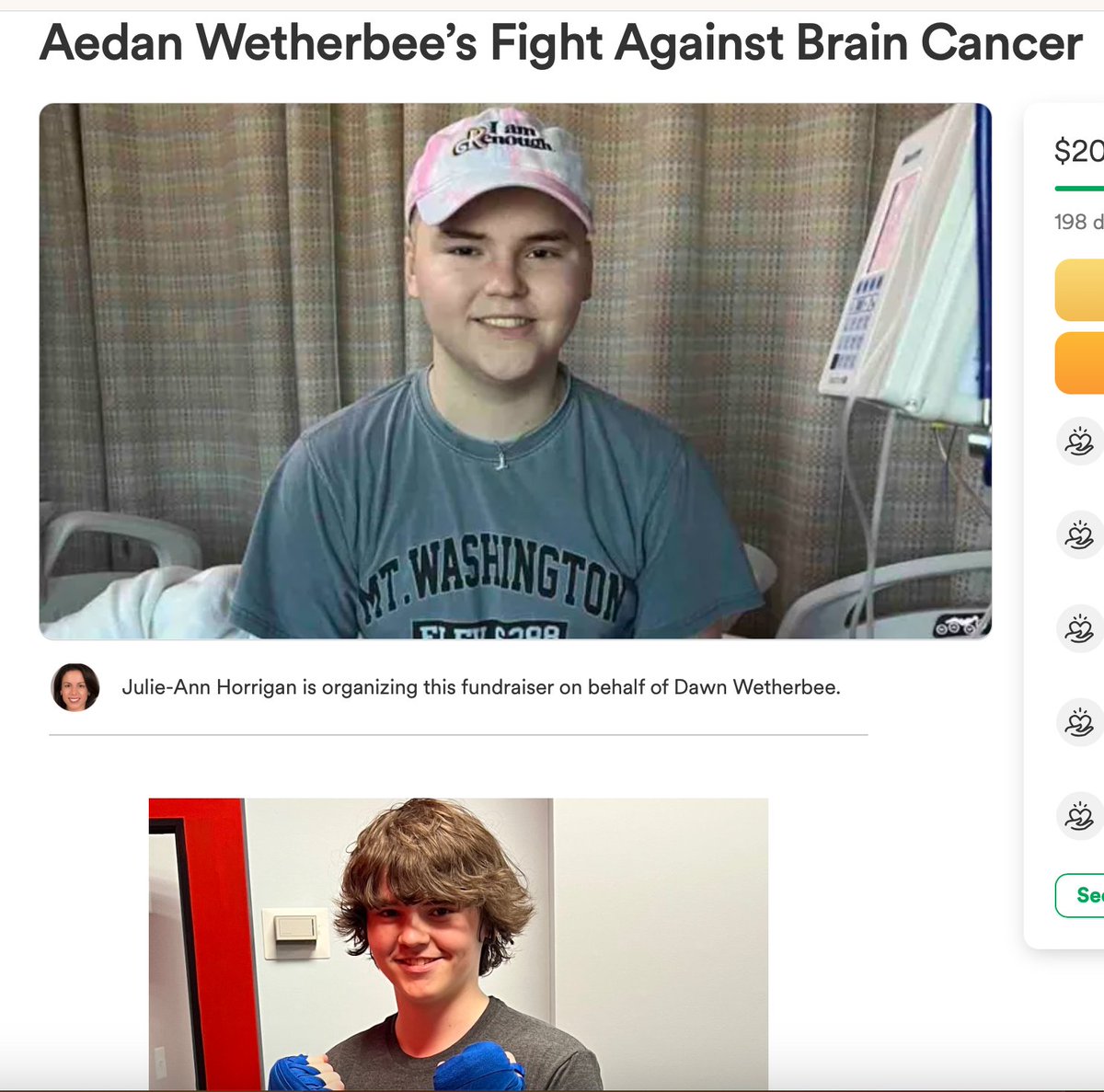 janiesaysyay's tweet image. 06/23 15yr old, Anaplastic Large Cell Lymphoma ALCL&amp;gt;
#CorrelationNotCausation